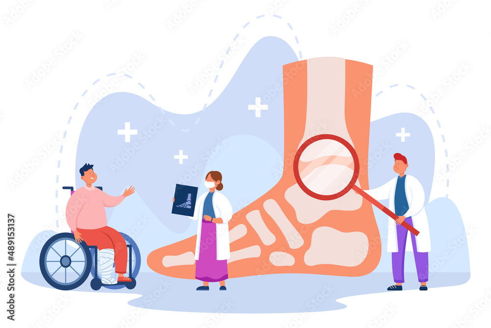 Vetor de Tiny doctor examining broken foot flat vector illustration