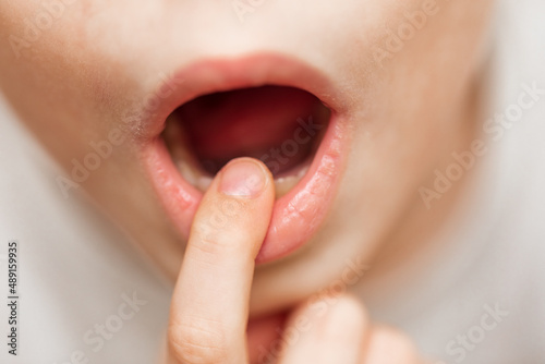 Tableau sur toile Child's finger in the mouth
