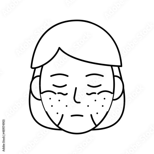 systemic lupus erythematosus line icon vector illustration