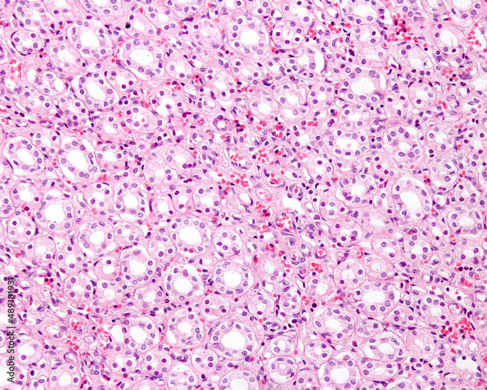 Kidney medulla Kidney medulla