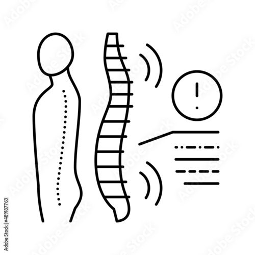 spondyloarthropathies health problem line icon vector illustration
