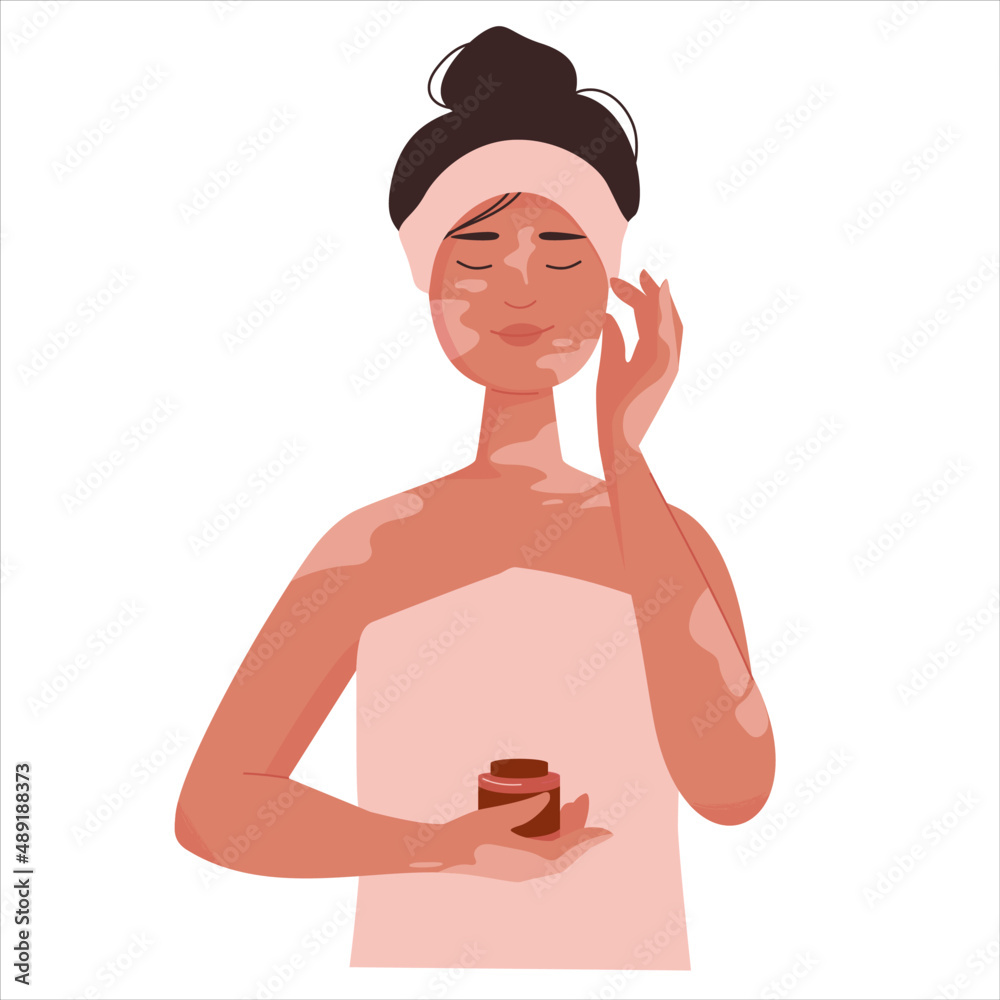 Cute girl with vitiligo take care facial routine with cream. Everyday