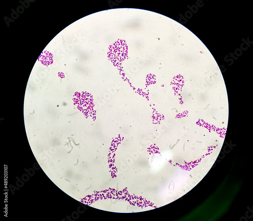 Blood agar bacterial colonies gram stained microscopic show Salmonella Typhi (S. Typhi) bacteria photo