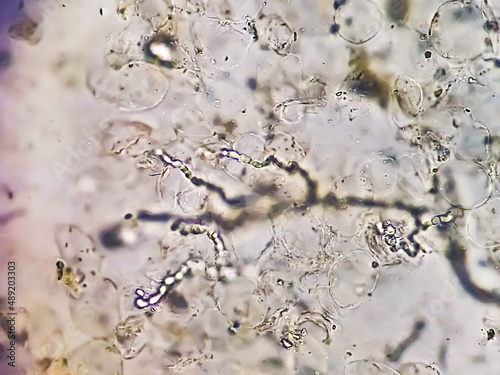 Microscopic image of dermatophytes. Skin scraping for fungus test photo