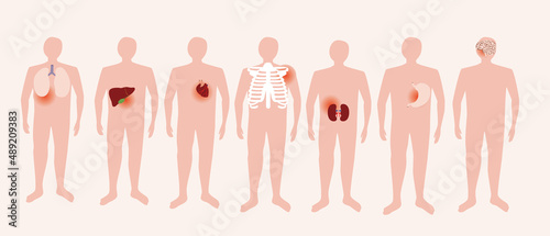 Pain in body, isolated people with human organs, Flat vector stock illustration, Diseases of lungs, liver, heart, stomach, brain