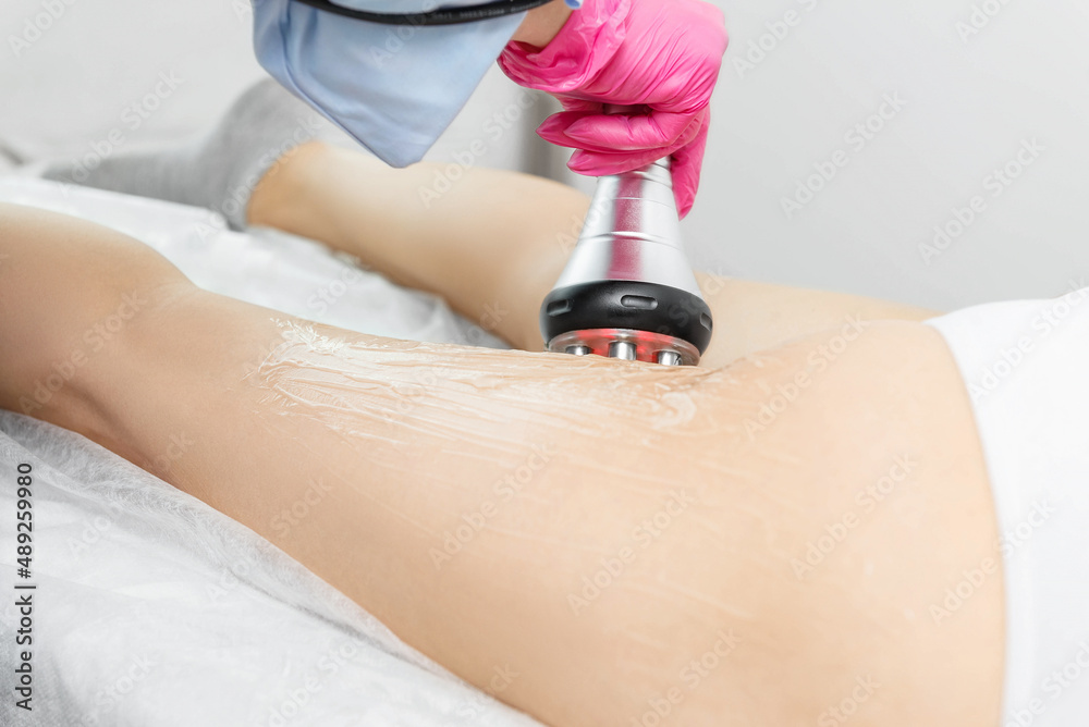 Anti-cellulite massager RF-lifting of thighs in beauty salon. Anti-cellulite massager RF-lifting of thighs in beauty salon.