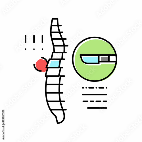 surgery scoliosis color icon vector illustration
