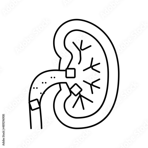 kidney stones line icon vector illustration