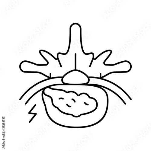 diskectomy patient disease line icon vector illustration