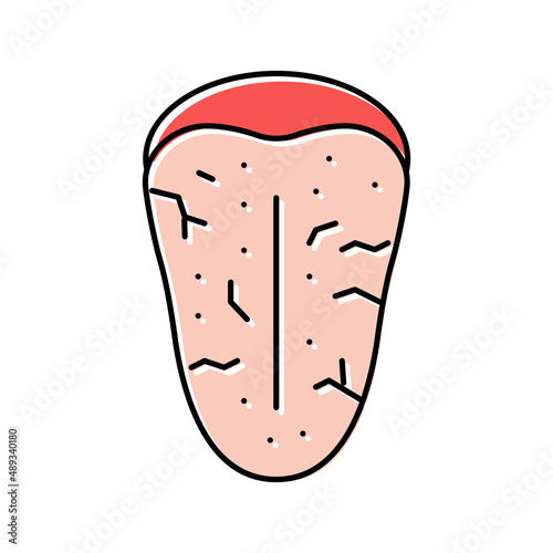 sjogrens syndrome color icon vector illustration photo