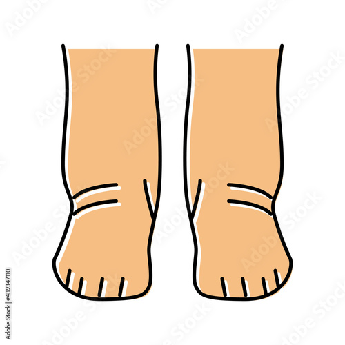 feet edema health disease color icon vector illustration