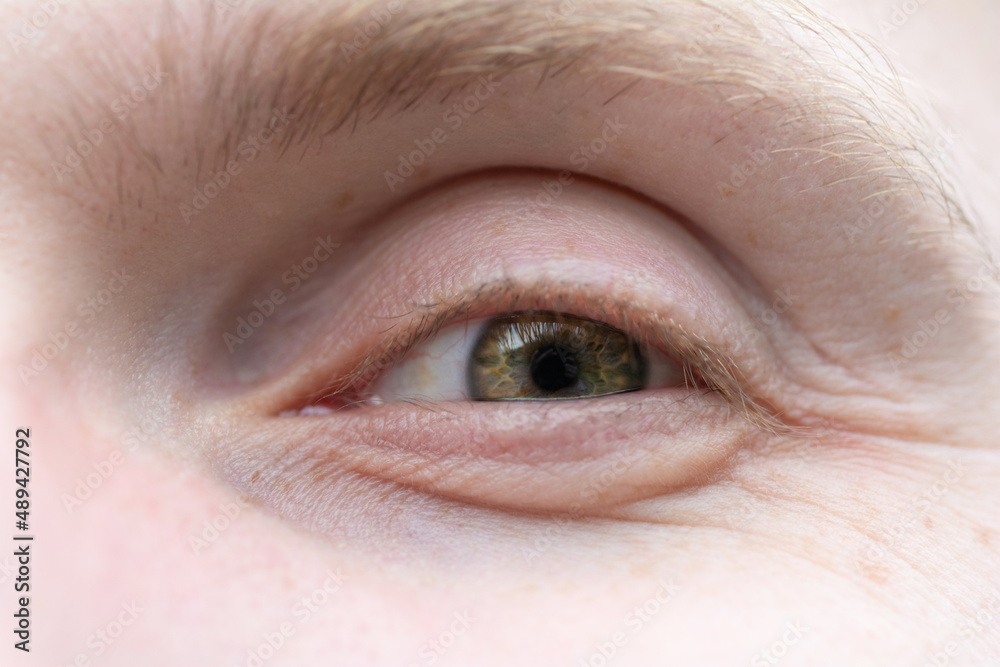Fototapeta premium Happy green eye of a man close-up. The eye of a European blond male with freckles