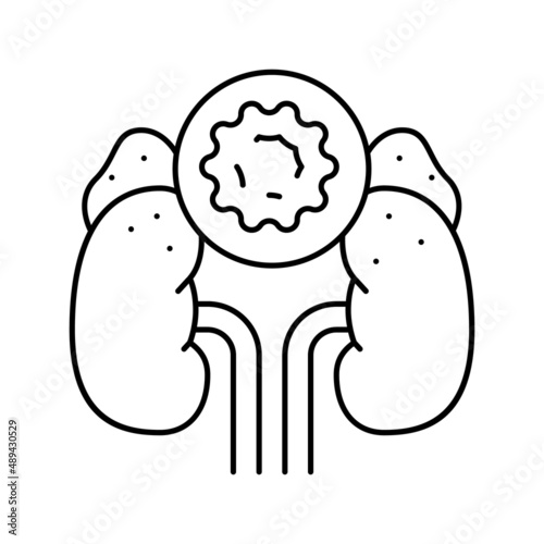 cushing cortisol syndrome line icon vector illustration
