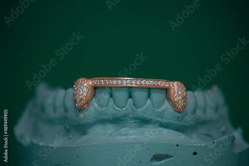 Grillz - Dental Jewelry  photo