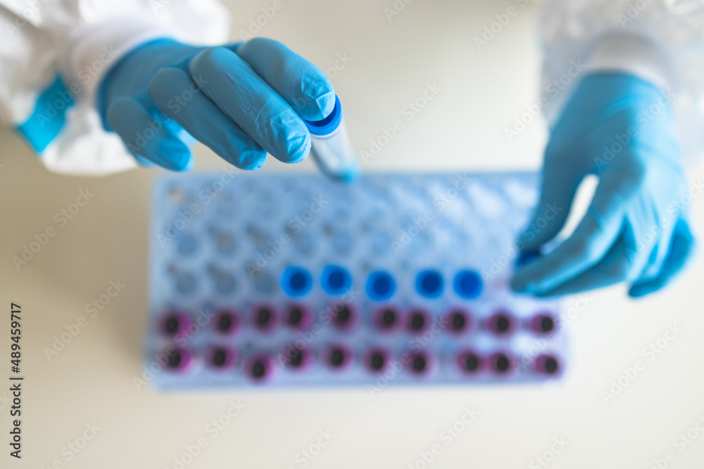 Process of coronavirus PCR antigen testing examination by nurse medic in laboratory lab, COVID-19 swab collection kit, test tube for taking OP NP patient specimen sample, patient receiving test Process of coronavirus PCR antigen testing examination by nurse medic in laboratory lab, COVID-19 swab collection kit, test tube for taking OP NP patient specimen sample, patient receiving test