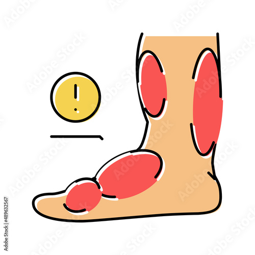 leg edema critical leg health problem color icon vector illustration
