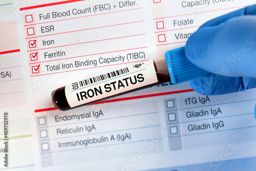 Blood tube test with requisition form for Iron status Test. Blood sample tube for analysis of Iron Status Tests. photo