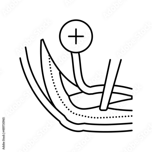 ulnar nerve release line icon vector illustration