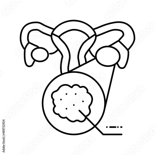 polycystic ovary syndrome endocrinology line icon vector illustration