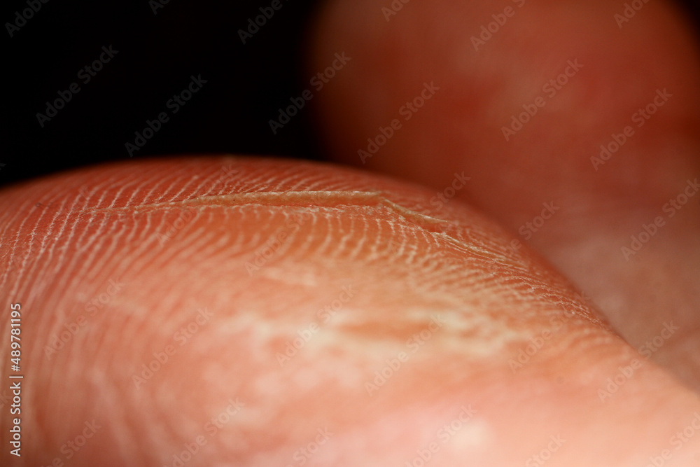 Fototapeta premium Macro texture of cracked foot