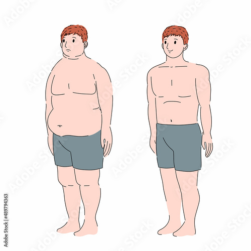 Fat patient. Weight loss before and after. Obesity character. Reduction of the stomach. Sports, fitness and healthy eating. Vector cartoon character on white background.