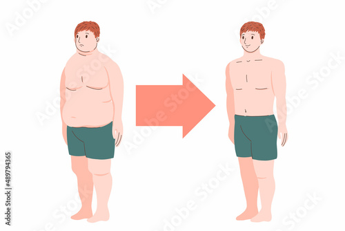 before and after losing weight fat person. obesity and excess weight. fat and muscle. man leads healthy lifestyle. figure in underpants. patient with diabetes. body positive. vector cartoon.