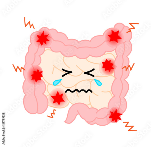 炎症を起こしている腸