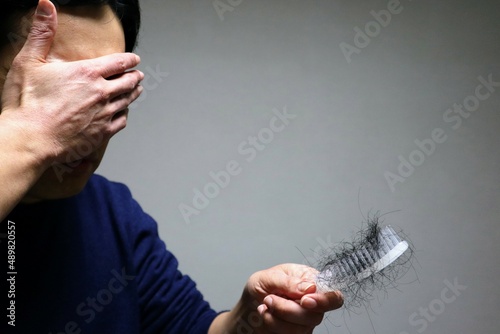 髪の抜け毛に悩む日本人男性