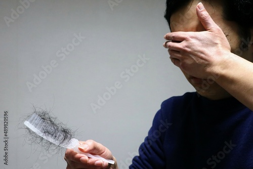 髪の抜け毛に悩む日本人男性