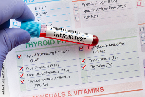 Blood sample tube for analysis of Thyroid tests in laboratory. Blood tube test with requisition form for Thyroid gland test photo