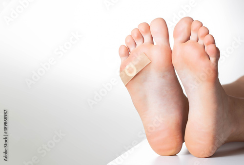 Woman's foot with glued medical plaster for plantar wart. Treatment of calluses and warts on the feet. Copy space for text