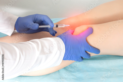 The doctor makes an injection of platelet-rich plasma, autostimulation of the regenerative processes of the joints, close-up