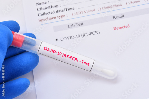 COVID-19 detected, laboratory report of COVID-19 testing by using RT-PCR method, the result showed detected or positive, sample from nasopharyngeal swab  photo