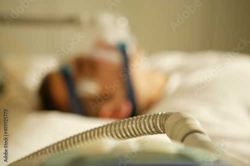 Patient mit kuenstlicher Beatmung   photo