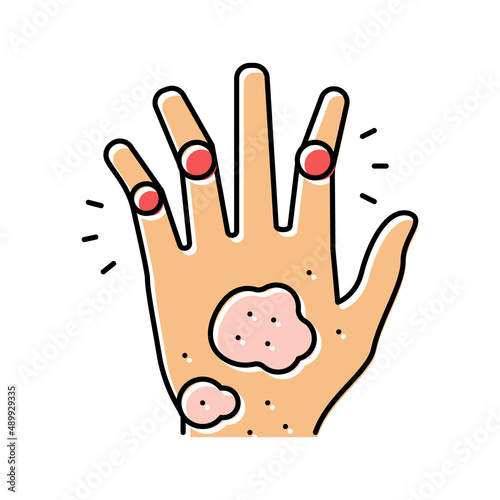 psoriatic arthritis skin health problem color icon vector illustration