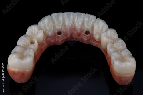Tooth Morphology Dental Lower Ceramics Ceramic Jaws on Black Glass