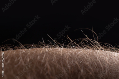 Human skin with hair on black background. Goose bumps photo