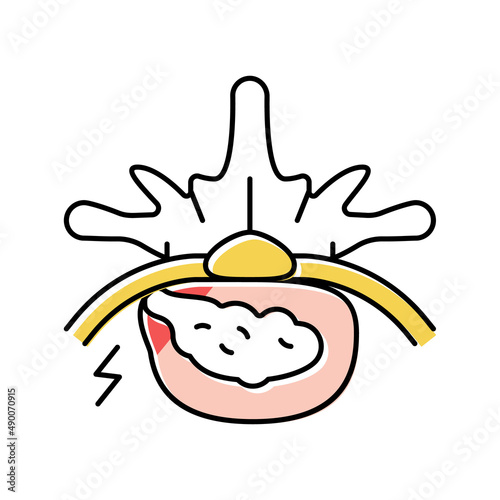 diskectomy patient disease color icon vector illustration