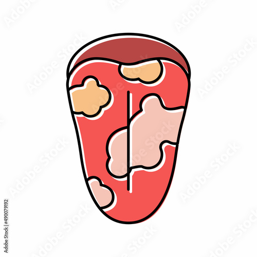 glossitis disease color icon vector illustration