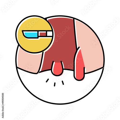 hemorrhoids disease color icon vector illustration