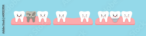 Dead tooth, lost stage, dental implant cute character in gum isolated on blue background. Teeth and implant prosthesis concept. Flat design cartoon kawaii vector orthodontist dentistry illustration.