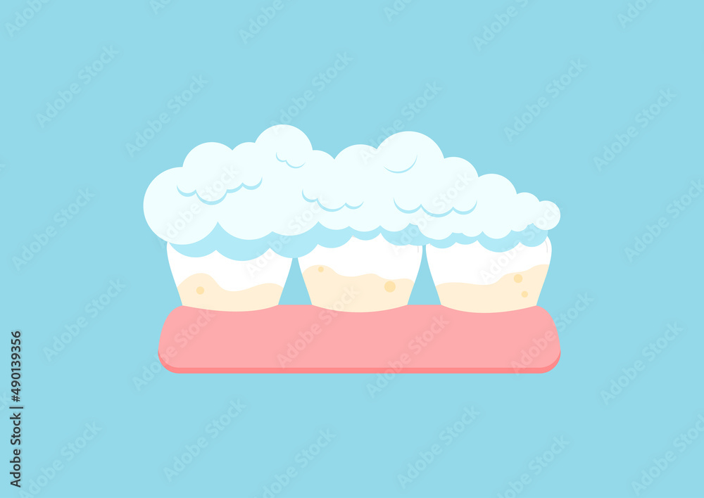 Tooth with yellow tartar plaque and toothpaste. Teeth in gum stain treatment, remove calculus and cleaning, whitening concept. Flat cartoon vector illustration. Dental hygiene. Tooth with yellow tartar plaque and toothpaste. Teeth in gum stain treatment, remove calculus and cleaning, whitening concept. Flat cartoon vector illustration. Dental hygiene.