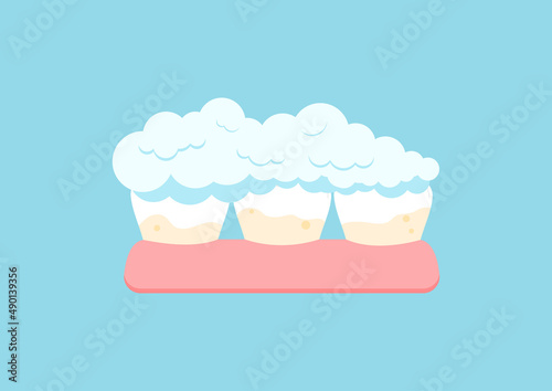 Tooth with yellow tartar plaque and toothpaste. Teeth in gum stain treatment, remove calculus and cleaning, whitening concept. Flat cartoon vector illustration. Dental hygiene.