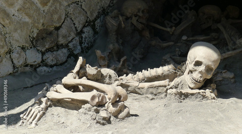 Canvas Print Excavation site with human bones and skull in the dust with more bones on the ba