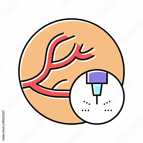 removal of vascular pathologies color icon vector illustration
