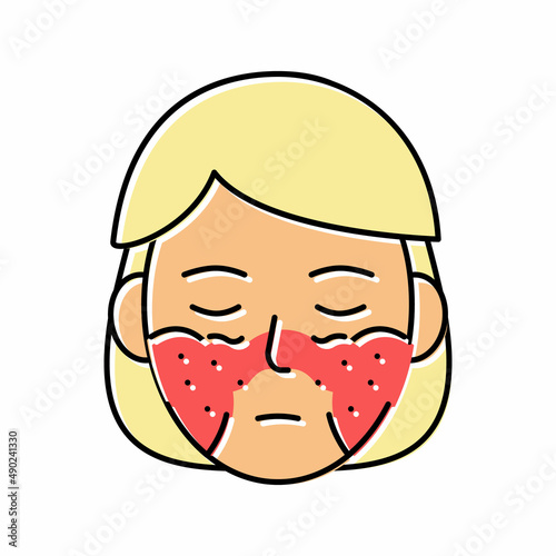 systemic lupus erythematosus color icon vector illustration