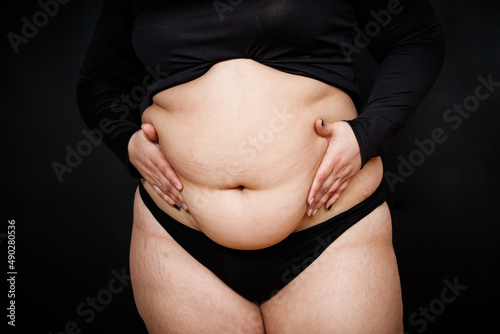 Canvastavla a woman with a fat belly and stretch marks on her skin on a black background