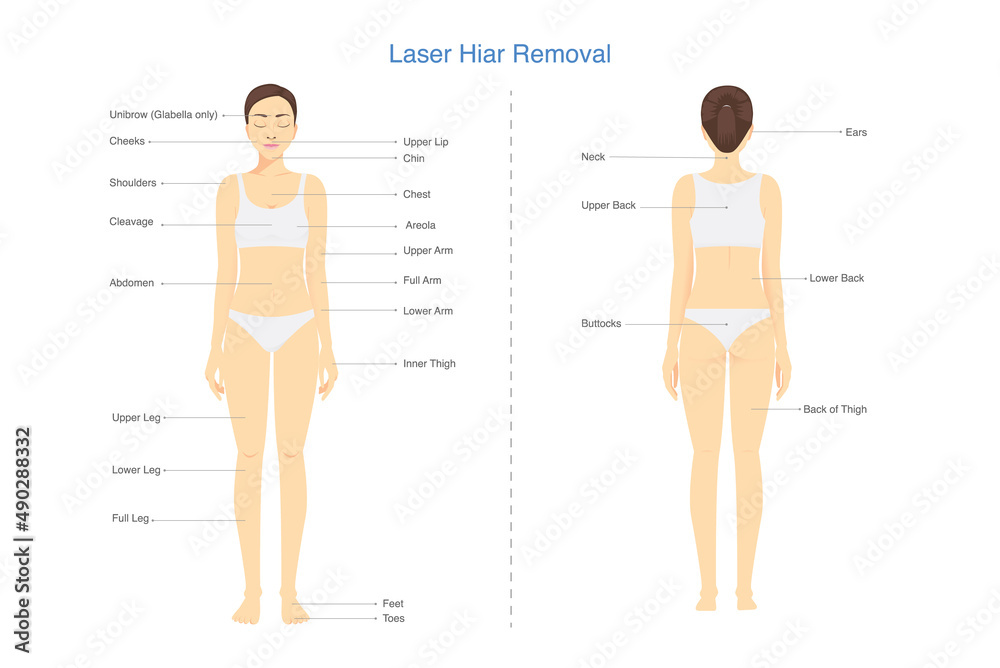 Popular points where Laser hair removal treatments on the people's body  area. Illustration about laser clinic diagram for beauty treatment. Stock  Vector | Adobe Stock