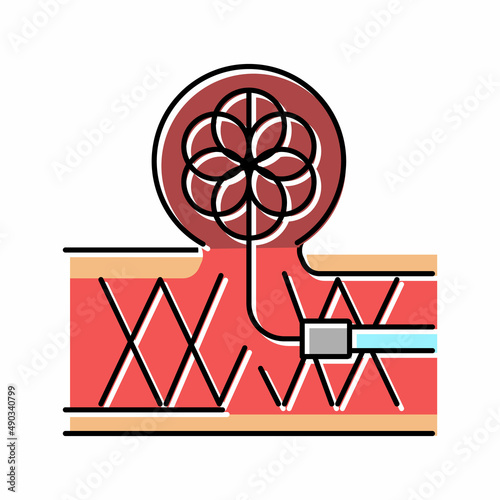 coil embolization color icon vector illustration