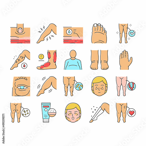 Edema Disease Symptom Collection Icons Set Vector .